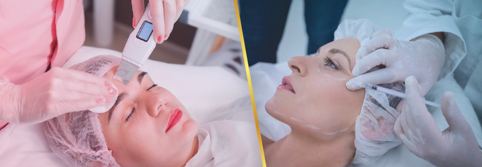 Laser Treatment