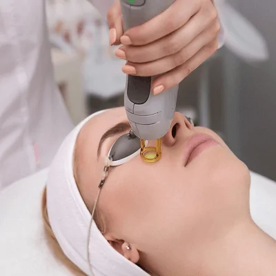 Laser Treatments